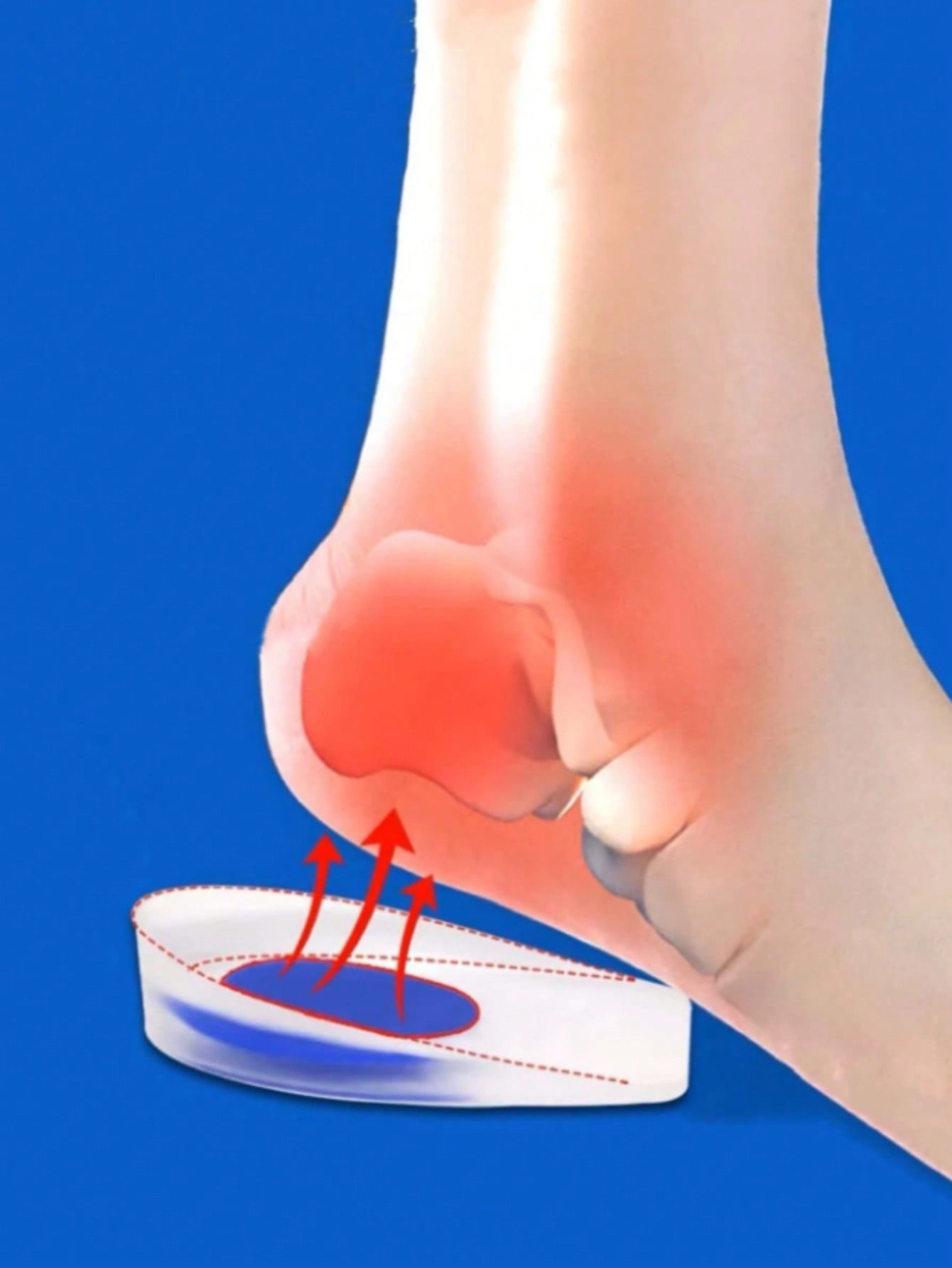QKC 2pcs Heel Pain Relief Pads - PU Gel Heel Cups, For Protecting Heel Spurs And Shock Absorption In Sports Shoes, For Women Men Sneakers Shoes Men Trainers Running Shoes Summer, Accessories Gift Idea