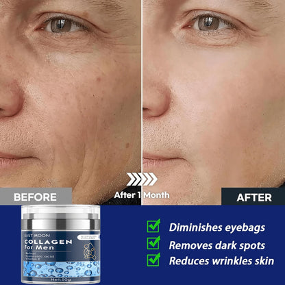 EAST MOON Retinol Collagen Cream For Face With 5% Hyaluronic Acid Anti-Aging Cream Anti-Wrinkle Reduce Fine Lines Lifting And Firming 24-Hour Facial Care Suitable For All Skin Types