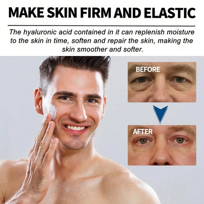 EAST MOON Retinol Collagen Cream For Face With 5% Hyaluronic Acid Anti-Aging Cream Anti-Wrinkle Reduce Fine Lines Lifting And Firming 24-Hour Facial Care Suitable For All Skin Types