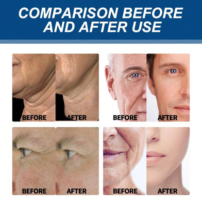 EAST MOON Retinol Collagen Cream For Face With 5% Hyaluronic Acid Anti-Aging Cream Anti-Wrinkle Reduce Fine Lines Lifting And Firming 24-Hour Facial Care Suitable For All Skin Types