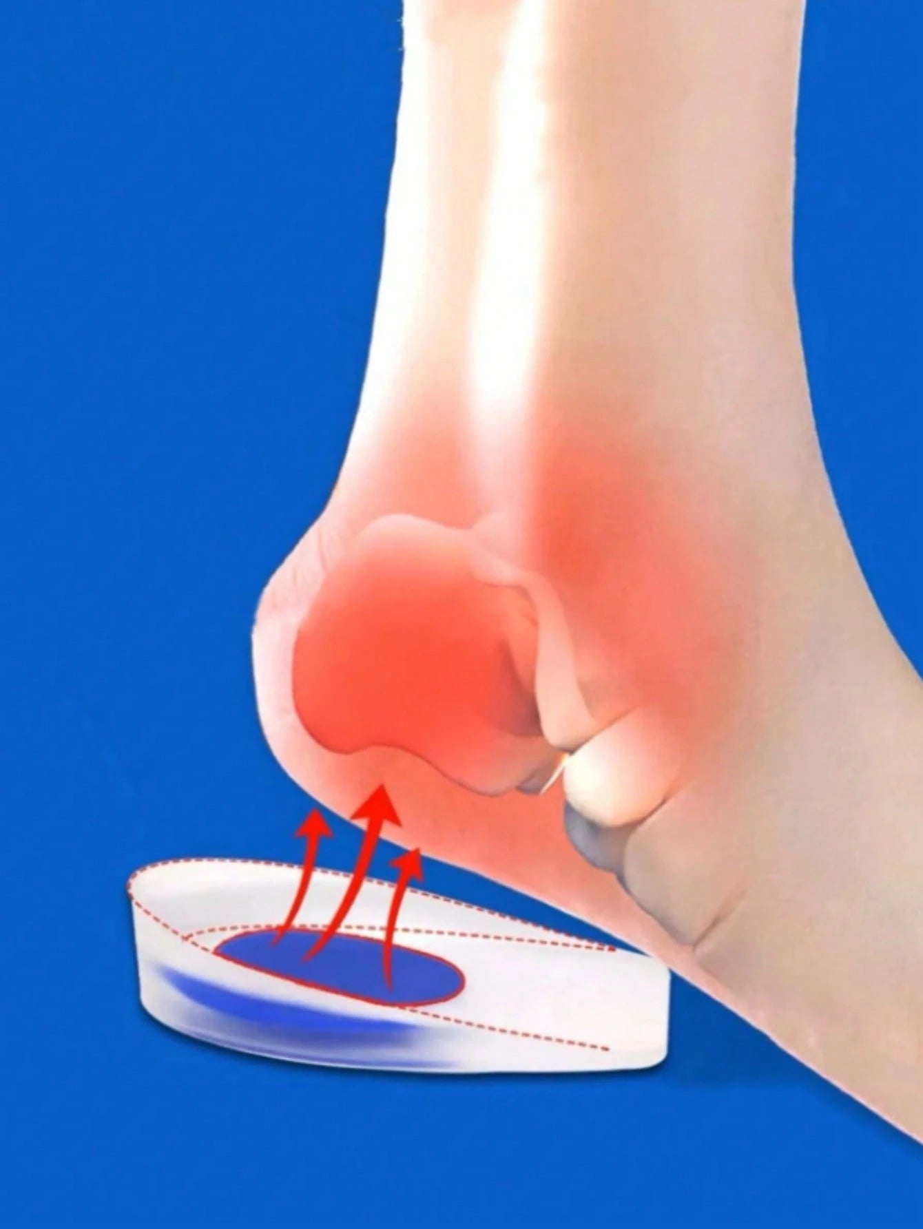 QKC 2pcs Heel Pain Relief Pads - PU Gel Heel Cups, For Protecting Heel Spurs And Shock Absorption In Sports Shoes, For Women Men Sneakers Shoes Men Trainers Running Shoes Summer, Accessories Gift Idea